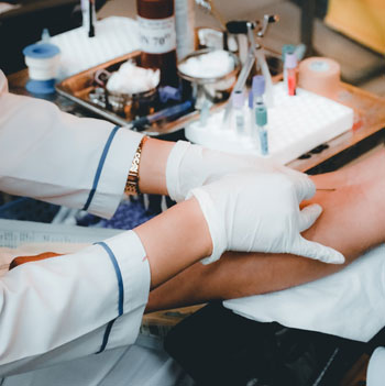 Дискретный (безаппаратный) плазмаферез