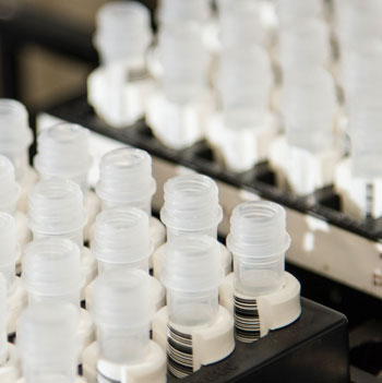 Мембранный (аппаратный) плазмаферез