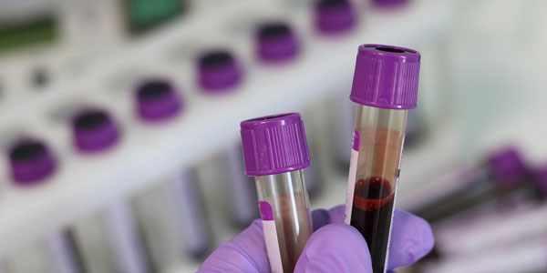 У.Ф.О. крови Днепр в Днепропетровской области