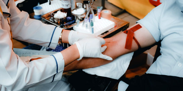 Дискретный плазмаферез